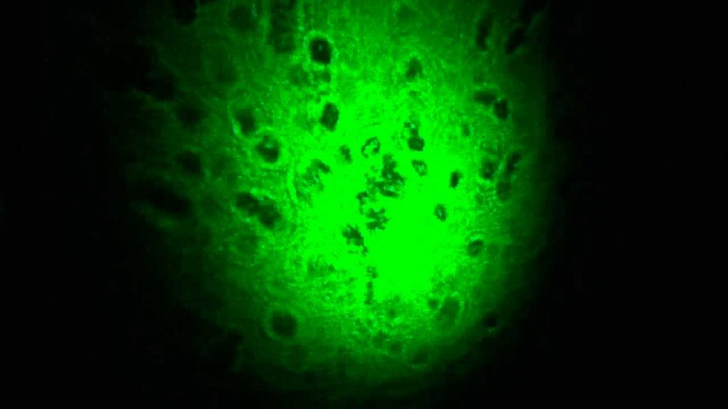 laser-bacterias